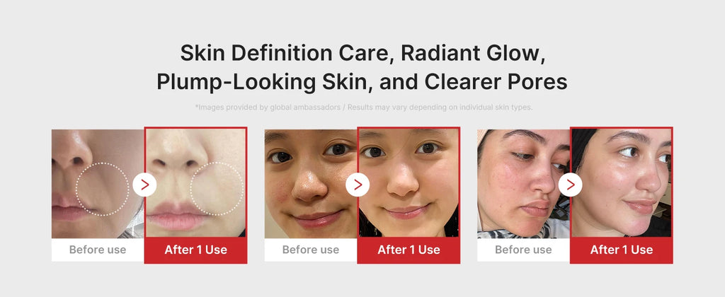 Multi functional four-color beauty device, with 4 Modes  Enhanced Absorption, Radiance, Elasticity, Facial Contouring,with 4 Mod