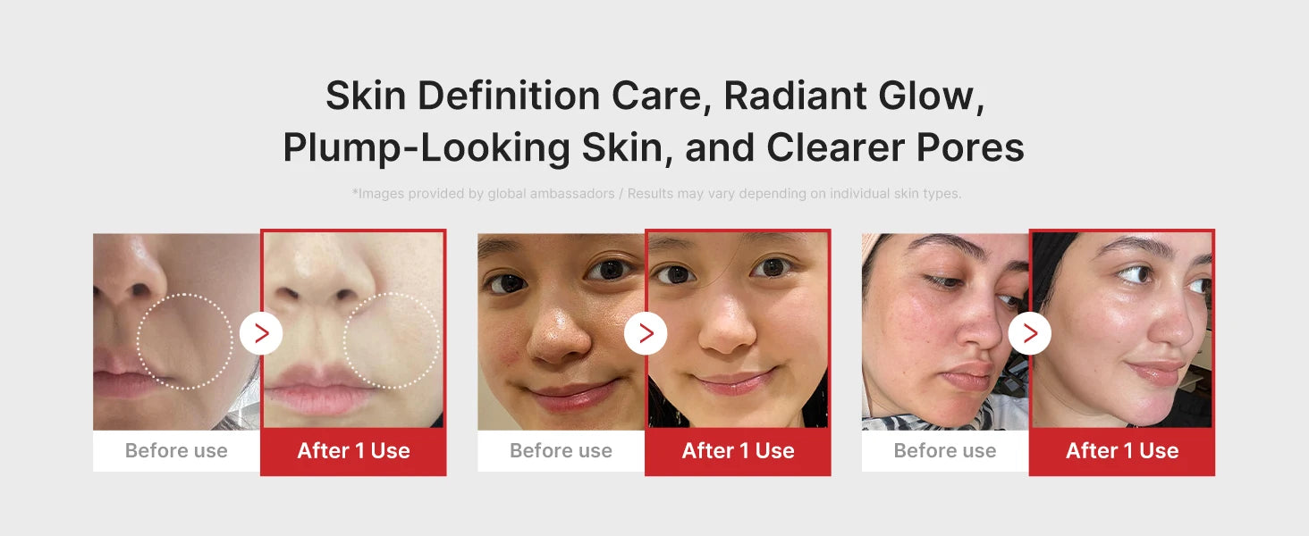 Multi functional four-color beauty device, with 4 Modes  Enhanced Absorption, Radiance, Elasticity, Facial Contouring,with 4 Mod